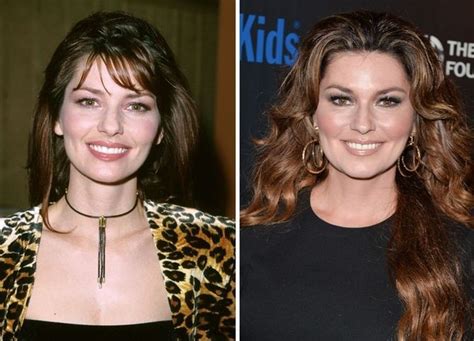 shania twain before after